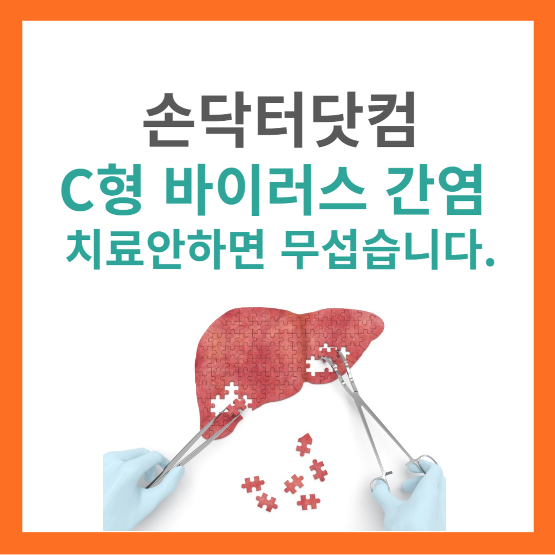 C형 간염 HCV