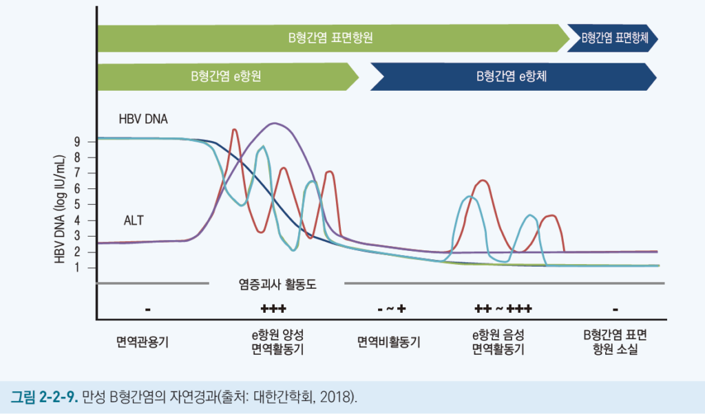 B형 간염