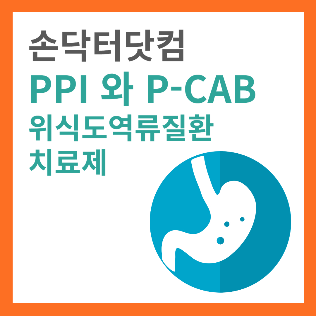 PPI 와 P-CAB