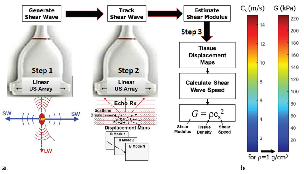 shear wave elastography