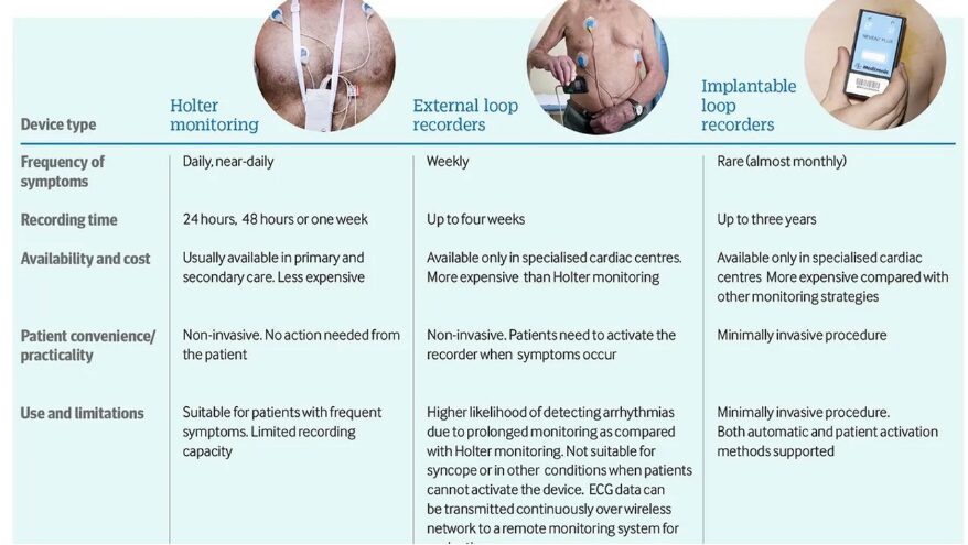 이식형 심장 사건 기록기 (Implantable loop recorder)