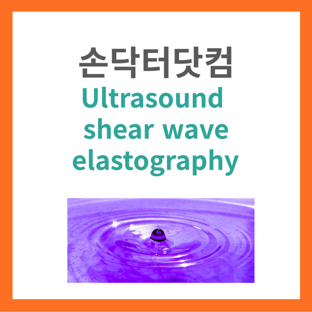 Ultrasound shear wave elastography