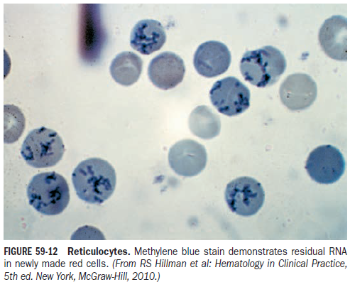 Reticulocyte Production Index (RPI) Calculator 1 Smart Online Doctor - image